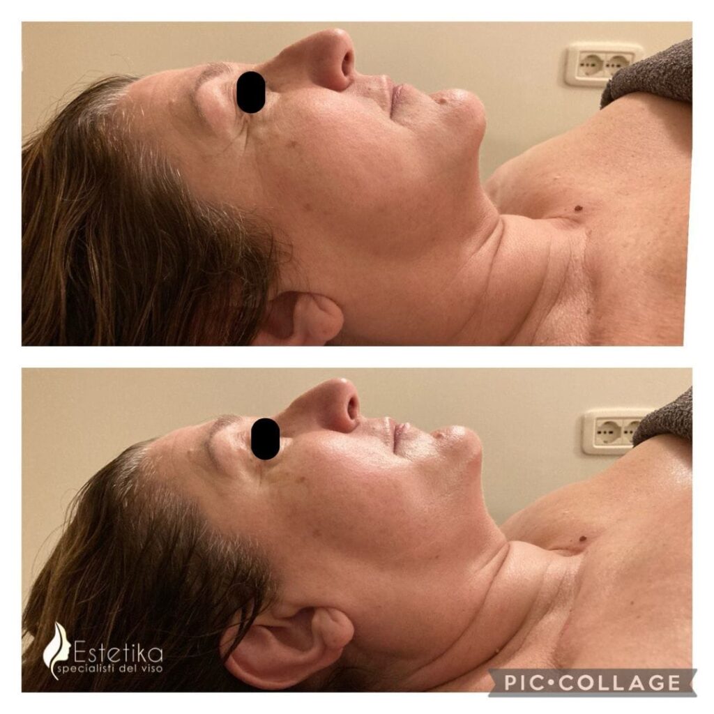 66ec3df3d25be_Rabbia1